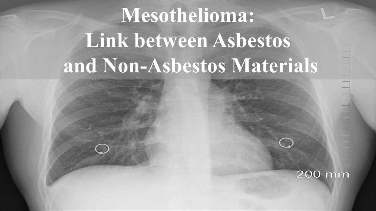 mesothelioma: link between asbestos and non-asbestos materials written in box on xray of lungs showing faded area representing cancer